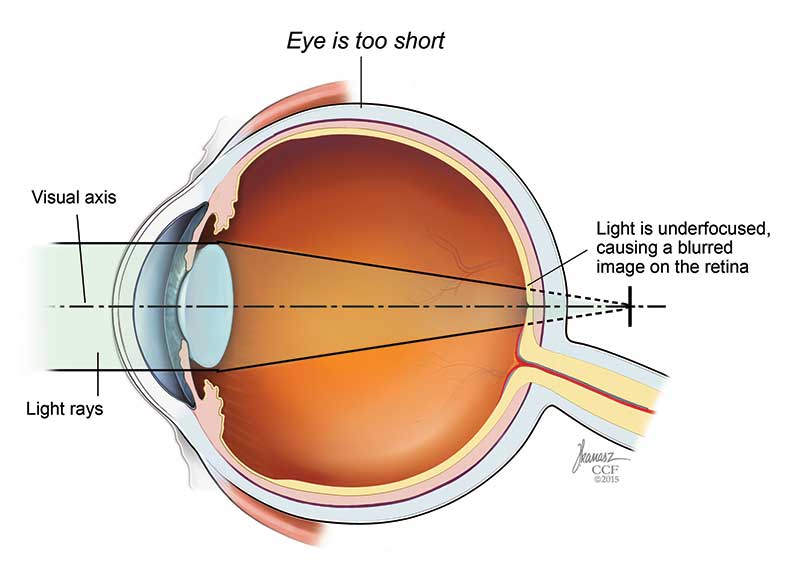 Stellar Integrated Eye Care | Home